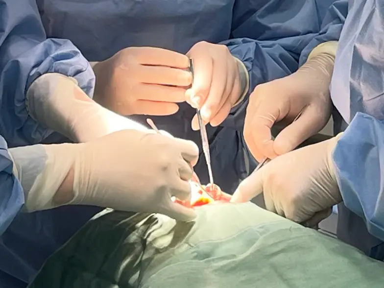 フラップレスインプラント